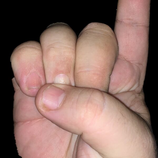 IMG 0106 1  Thumbnail